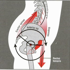 anterior pelvic tilt