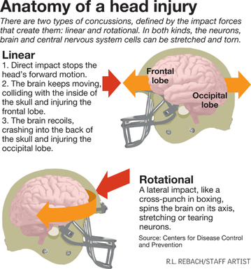 impulsive force concussion image