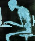 Hunched Posture on Computer